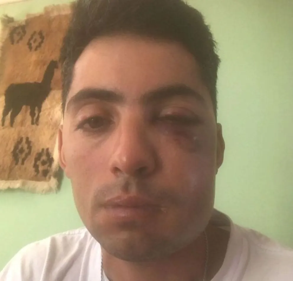 El mánager de Sele Vera fue imputado por lesiones graves a un sonidista