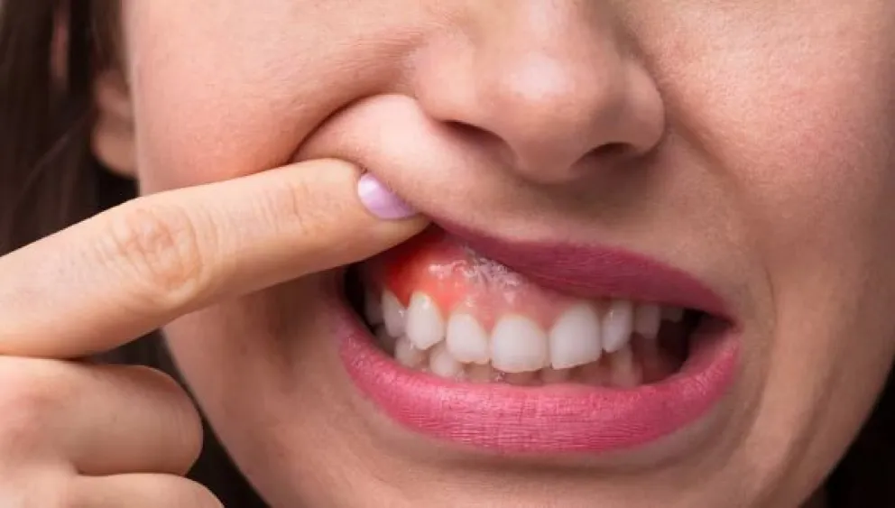 “Día de la Salud de las Encías”, ¿cuánto conocemos sobre ellas?